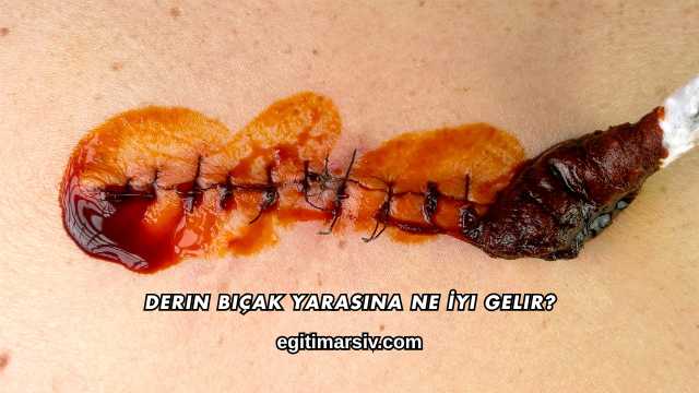 Derin Bıçak Yarasına Ne İyi Gelir?