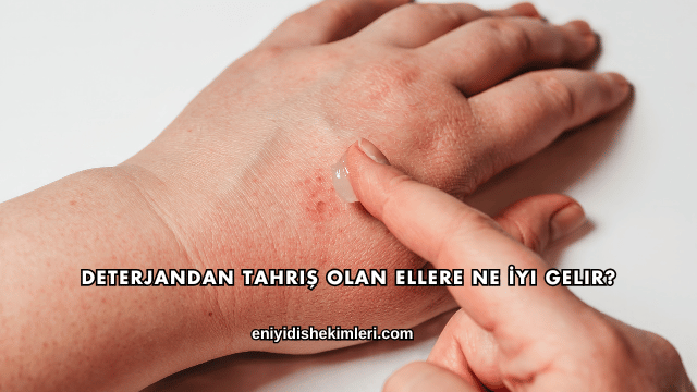 Deterjandan Tahriş Olan Ellere Ne İyi Gelir?