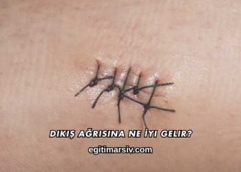 Dikiş Ağrısına Ne İyi Gelir?