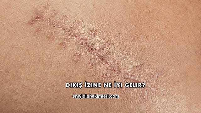 Dikiş İzine Ne İyi Gelir?