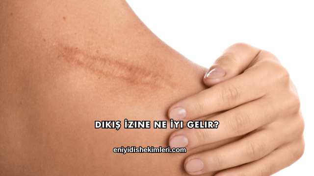 Dikiş İzine Ne İyi Gelir?