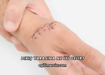 Dikiş Yarasına Ne İyi Gelir?