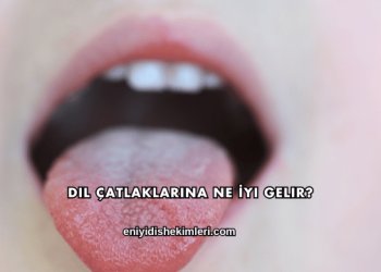 Dil Çatlaklarına Ne İyi Gelir?