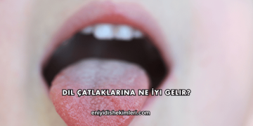 Dil Çatlaklarına Ne İyi Gelir?