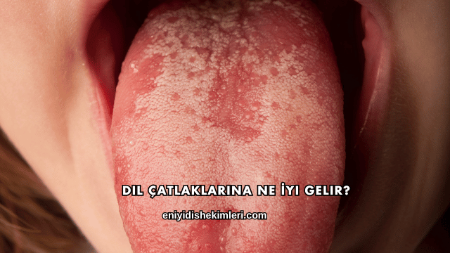 Dil Çatlaklarına Ne İyi Gelir?