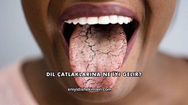 Dil Çatlaklarına Ne İyi Gelir?
