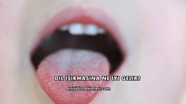 Dil Isırmasına Ne İyi Gelir?