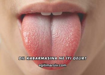 Dil Kabarmasına Ne İyi Gelir?