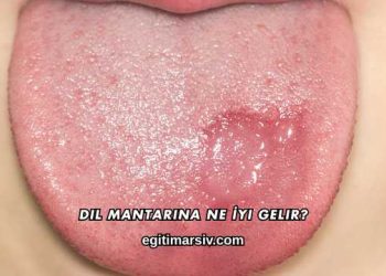 Dil Mantarına Ne İyi Gelir?