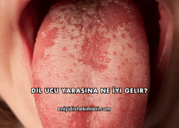 Dil Ucu Yarasına Ne İyi Gelir?