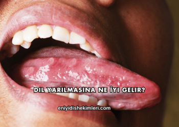 Dil Yarılmasına Ne İyi Gelir?