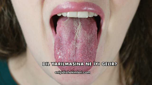 Dil Yarılmasına Ne İyi Gelir?