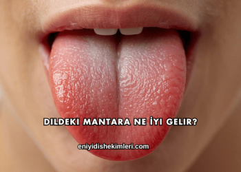 Dildeki Mantara Ne İyi Gelir?