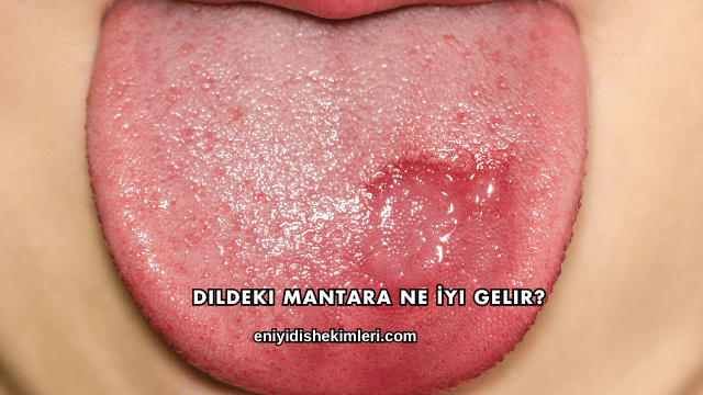 Dildeki Mantara Ne İyi Gelir?