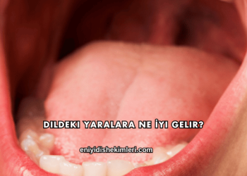 Dildeki Yaralara Ne İyi Gelir?