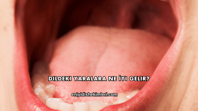 Dildeki Yaralara Ne İyi Gelir?