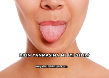 Dilin Yanmasına Ne İyi Gelir?