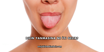 Dilin Yanmasına Ne İyi Gelir?