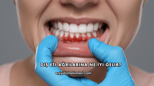 Diş Eti Ağrılarına Ne İyi Gelir?