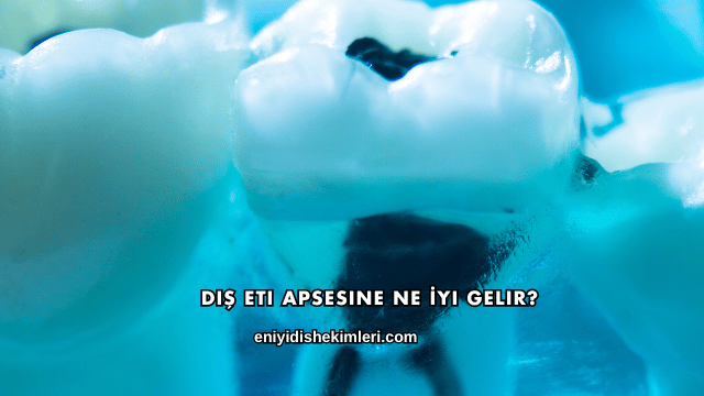 Diş Eti Apsesine Ne İyi Gelir?