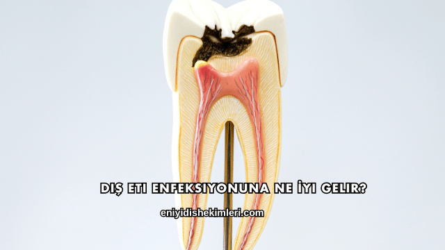 Diş Eti Enfeksiyonuna Ne İyi Gelir?