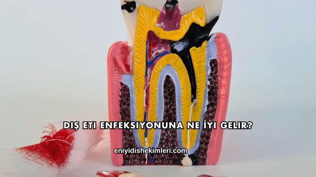 Diş Eti Enfeksiyonuna Ne İyi Gelir?