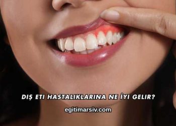 Diş Eti Hastalıklarına Ne İyi Gelir?