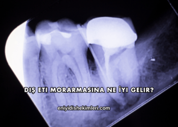 Diş Eti Morarmasına Ne İyi Gelir?