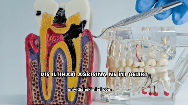 Diş İltihabı Ağrısına Ne İyi Gelir?