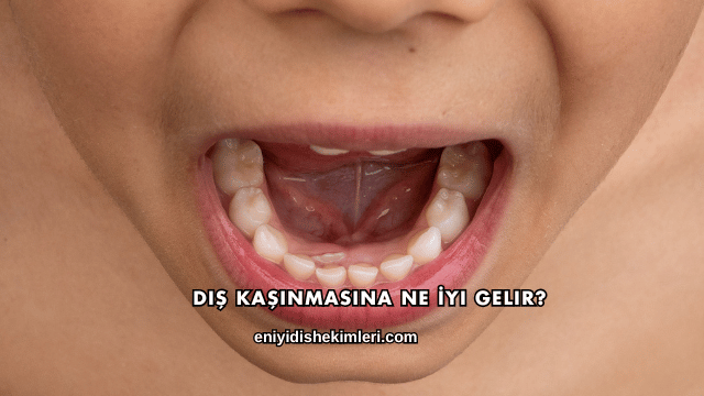 Diş Kaşınmasına Ne İyi Gelir?