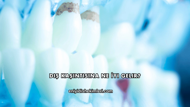 Diş Kaşıntısına Ne İyi Gelir?