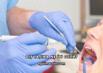 Diş Taşına Ne İyi Gelir?