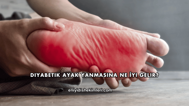 Diyabetik Ayak Yanmasına Ne İyi Gelir?