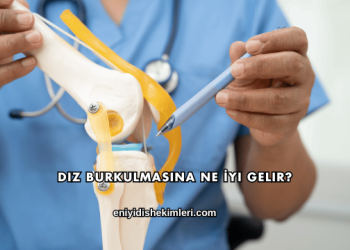 Diz Burkulmasına Ne İyi Gelir?