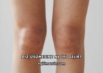 Diz Üşümesine Ne İyi Gelir?