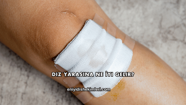 Diz Yarasına Ne İyi Gelir?