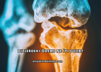 Dizlerdeki Ödeme Ne İyi Gelir?