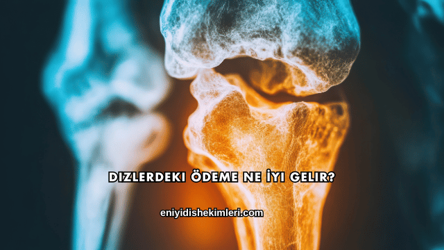 Dizlerdeki Ödeme Ne İyi Gelir?