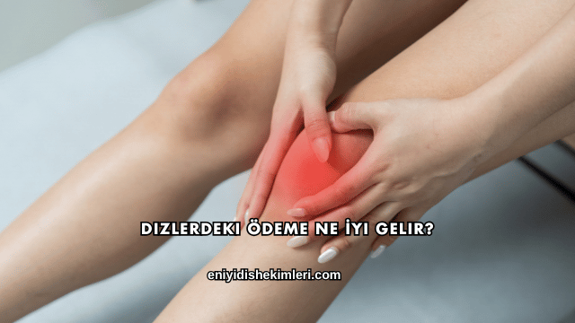 Dizlerdeki Ödeme Ne İyi Gelir?