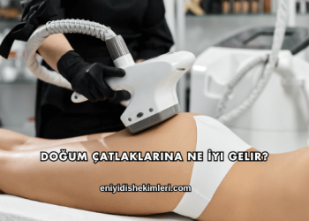 Doğum Çatlaklarına Ne İyi Gelir?