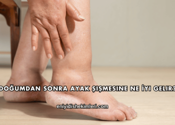 Doğumdan Sonra Ayak Şişmesine Ne İyi Gelir?