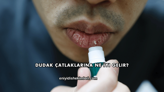 Dudak Çatlaklarına Ne İyi Gelir?