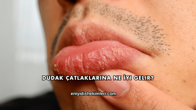 Dudak Çatlaklarına Ne İyi Gelir?