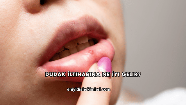 Dudak İltihabına Ne İyi Gelir?