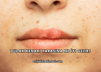 Dudak Kenarı Yarasına Ne İyi Gelir?