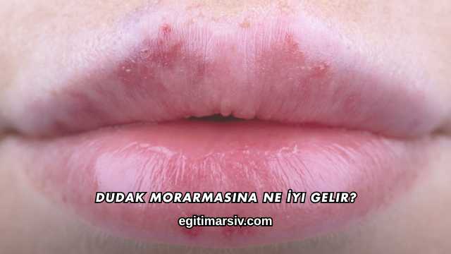 Dudak Morarmasına Ne İyi Gelir?