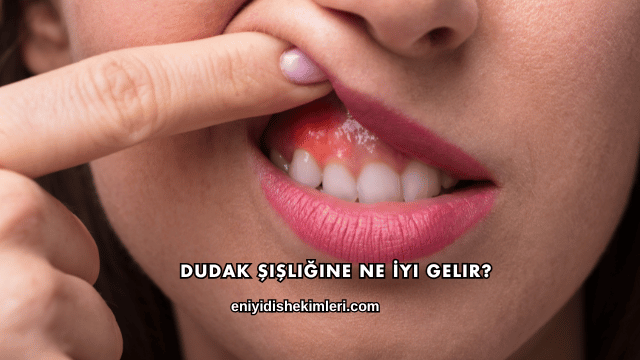 Dudak Şişliğine Ne İyi Gelir?