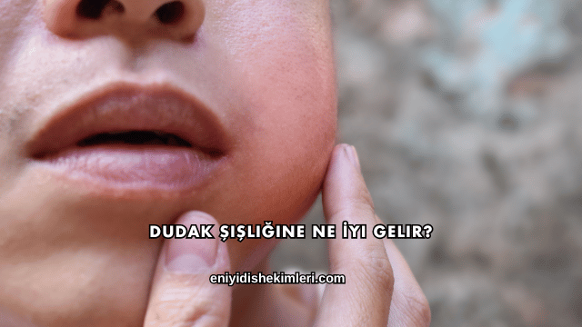 Dudak Şişliğine Ne İyi Gelir?