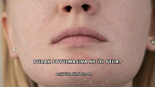 Dudak Soyulmasına Ne İyi Gelir?