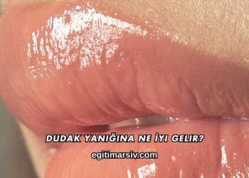 Dudak Yanığına Ne İyi Gelir?